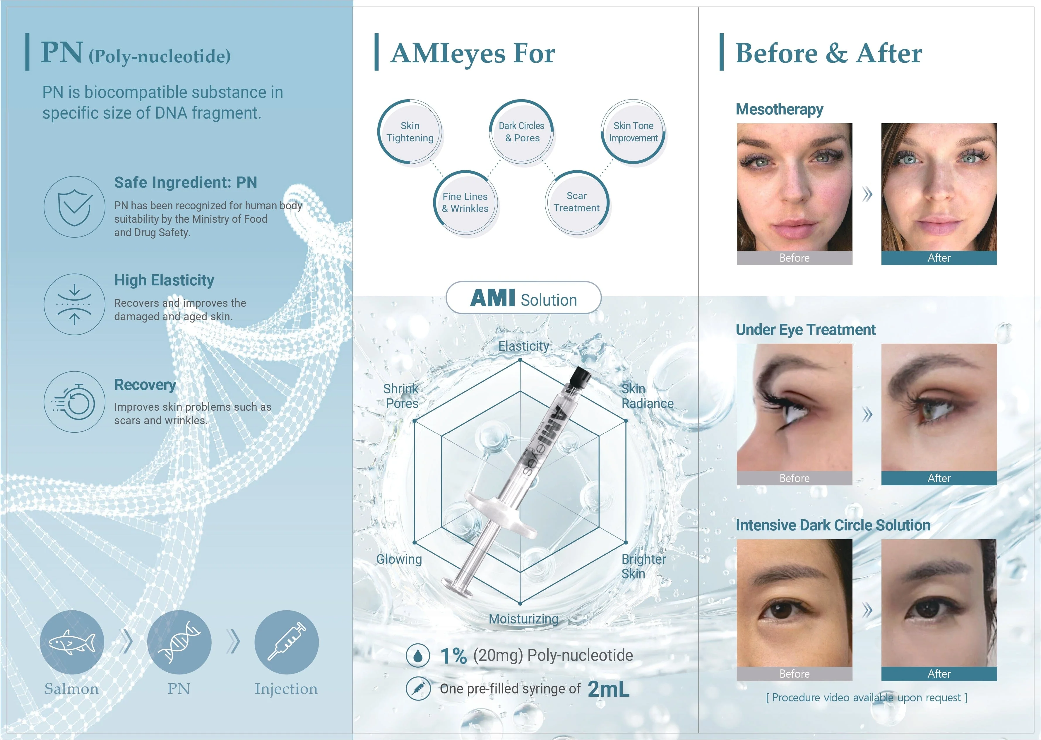 AMI EYES - Image 3